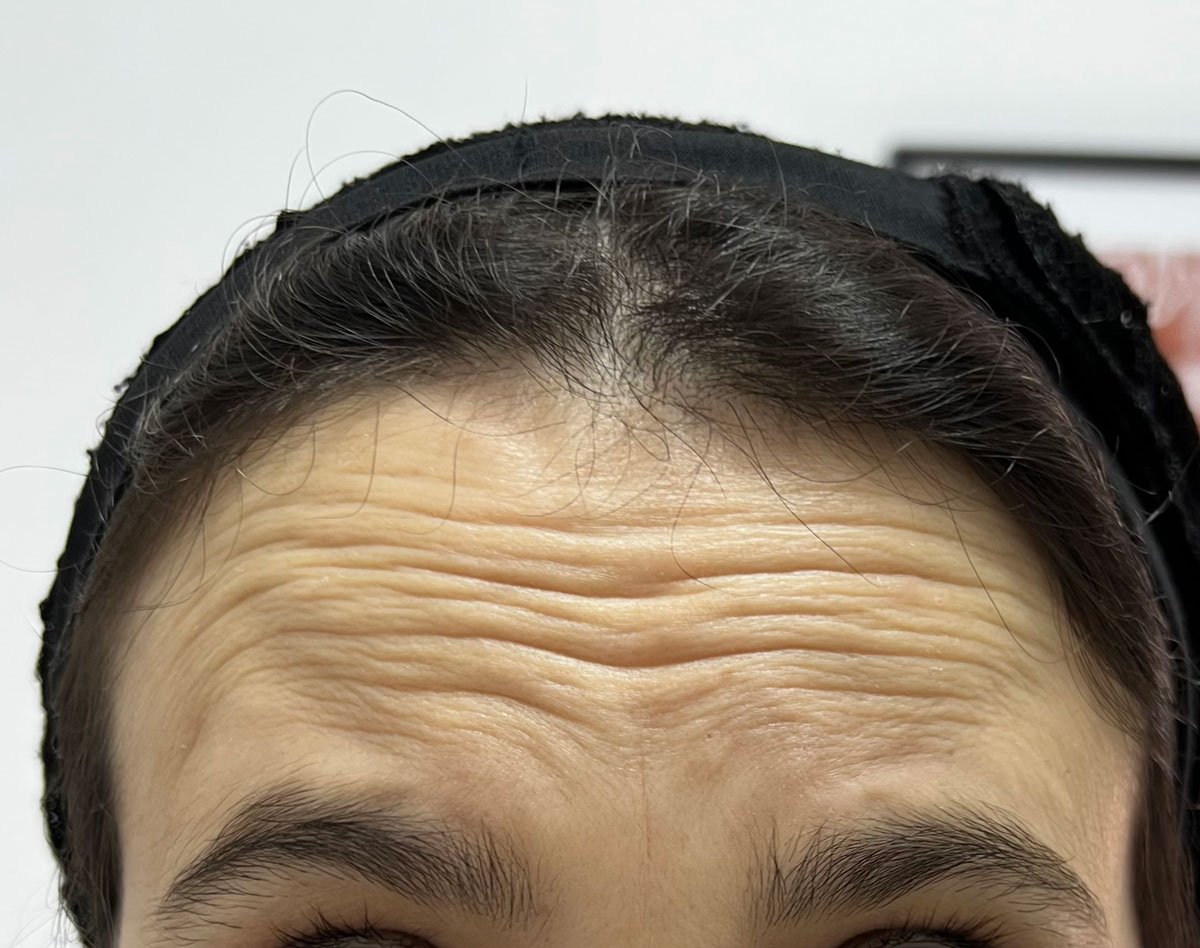 Antes